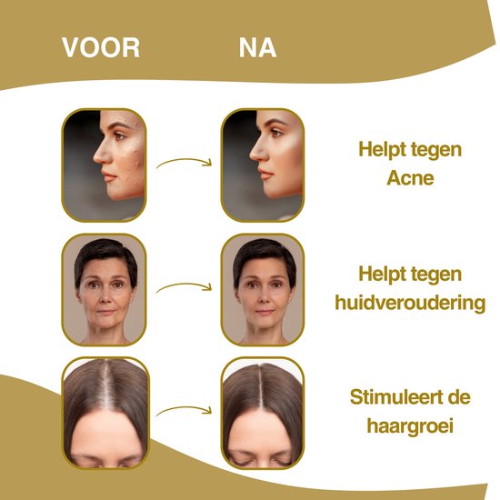 Lumivéra® Dermaroller 0.25mm – Baardroller met 540 Micro-naalden (incl. eBook)